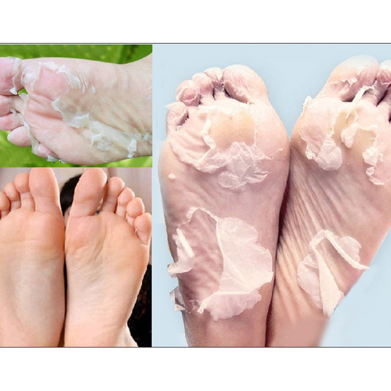 BabySkin - Ultimate Foot Peeling Mask