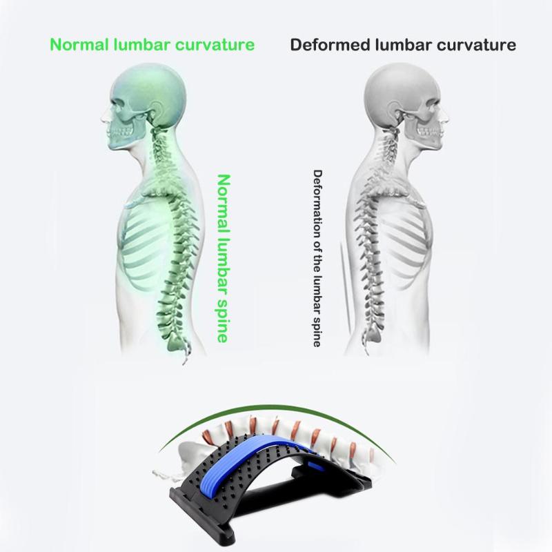 BackCorrector - Posture Correcting Back Stretcher